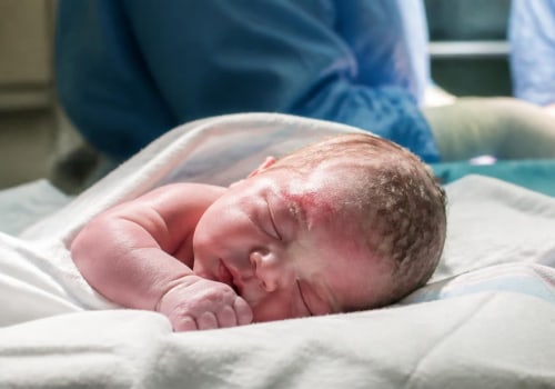 Infant Skull Fractures and Medical Malpractice: When Forceps Errors, Vacuum Extraction, or Delayed Diagnosis May Cause Preventable Birth Injuries